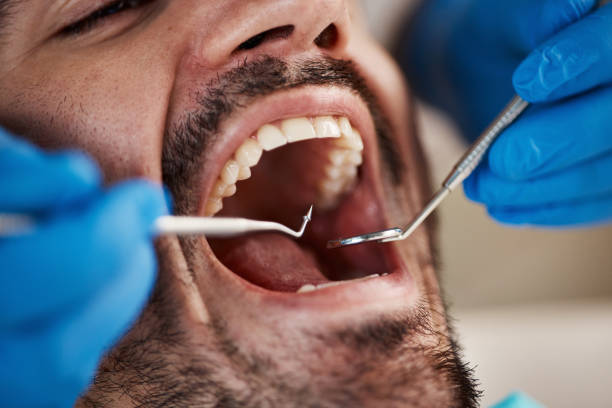 Best Emergency Cosmetic Dentistry in Chapel Hill, NC