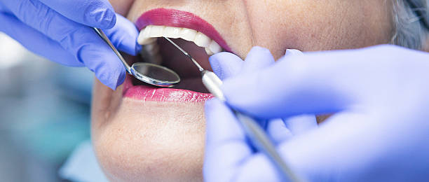 Best 24-Hour Emergency Dentist in Chapel Hill, NC